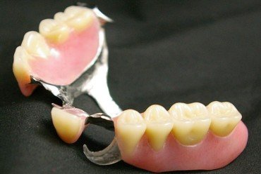 dent_3.jpg