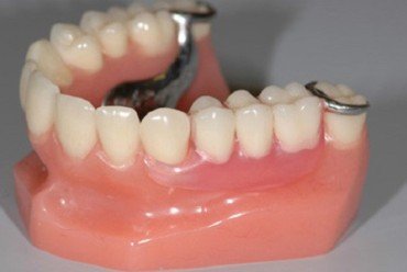 dent_4.jpg