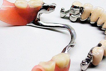 dent_5.jpg