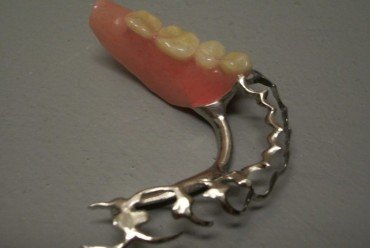 dent_8.jpg