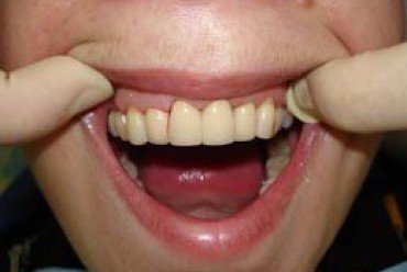 thumb_183_370_248_0_0_crop.jpg