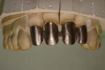thumb_185_370_248_0_0_crop.jpg